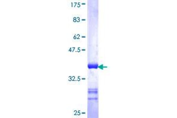 EPH Receptor A4 Protein (EPHA4) (AA 887-986) (GST tag)