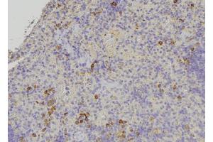 ABIN6278916 at 1/100 staining Human lymph node tissue by IHC-P. (Keratin 31 antibody)