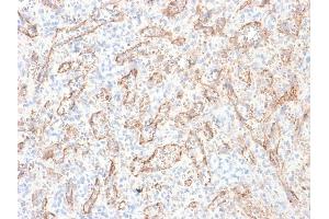 Immunohistochemistry (IHC) image for anti-Tumor Necrosis Factor (Ligand) Superfamily, Member 15 (TNFSF15) antibody (ABIN6941290)