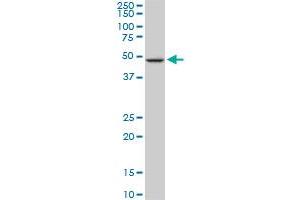 NEK2 monoclonal antibody (M11), clone 3B7. (NEK2 antibody  (AA 331-445))