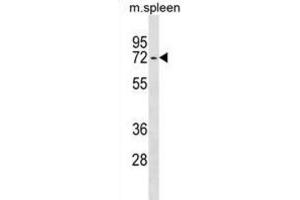 Western Blotting (WB) image for anti-Ectonucleoside Triphosphate diphosphohydrolase 4 (ENTPD4) antibody (ABIN3000013) (ENTPD4 antibody)