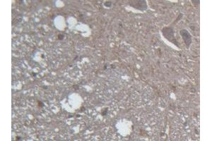 IHC-P analysis of Rat Spinal cord Tissue, with DAB staining. (GLRa2 antibody  (AA 28-253))