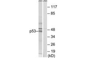 Western blot analysis of extracts from 293 cells, using p53 (Ab-378) Antibody. (p53 antibody  (AA 336-385))