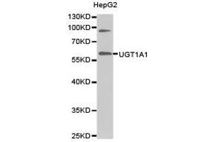 Western Blotting (WB) image for anti-UDP Glucuronosyltransferase 1 Family, Polypeptide A1 (UGT1A1) antibody (ABIN1875274) (UGT1A1 antibody)