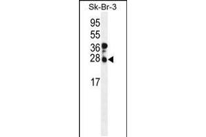 Western blot analysis of CHMP4B Antibody in SK-BR-3 cell line lysates (35ug/lane) (CHMP4B antibody  (N-Term))