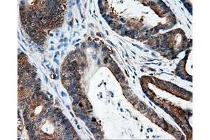 Immunohistochemistry (IHC) image for anti-Intraflagellar Transport 57 Homolog (IFT57) antibody (ABIN1498809) (IFT57 antibody)