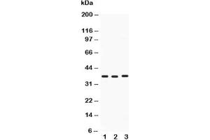 Western blot testing of Midkine antibody and Lane 1:  HeLa;  2: SMMC-7721;  3: SW620;  Predicted size: 16KD;  Observed size: 38KD (Midkine antibody  (AA 21-143))