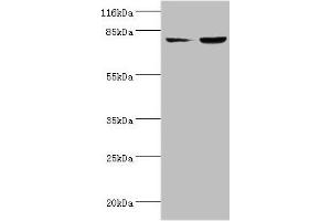 Western blot All lanes: ACSL4 antibody at 2 μg/mL Lane 1: HepG2 whole cell lysate Lane 2: Hela whole cell lysate Secondary Goat polyclonal to rabbit IgG at 1/10000 dilution Predicted band size: 80, 75 kDa Observed band size: 80 kDa (ACSL4 antibody  (AA 457-670))