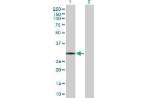 Western Blotting (WB) image for HLA-DQA1 293T Cell Transient Overexpression Lysate(Denatured) (ABIN1332136)