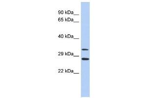 Western Blot showing BIRC7 antibody used at a concentration of 1-2 ug/ml to detect its target protein. (BIRC7 antibody  (Middle Region))