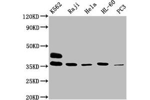 Western Blot Positive WB detected in: K562 whole cell lysate, Raji whole cell lysate, Hela whole cell lysate, HL60 whole cell lysate, PC-3 whole cell lysate All lanes: FCGR2A antibody at 1:2000 Secondary Goat polyclonal to rabbit IgG at 1/50000 dilution Predicted band size: 36, 35 kDa Observed band size: 36 kDa (FCGR2A antibody  (AA 241-317))