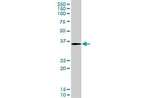 Western Blotting (WB) image for anti-STE20-Related Kinase Adaptor alpha (STRADA) (AA 251-347) antibody (ABIN599607) (STRADA antibody  (AA 251-347))