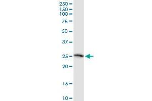 TWSG1 monoclonal antibody (M07), clone 2F3. (TWSG1 antibody  (AA 1-223))