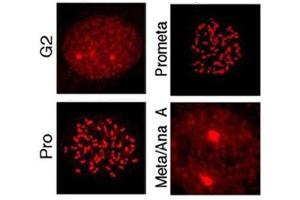 Immunostaining using  affinity purified anti-MLF1IP pT78 antibody shows detection of MLF1IP pT78 at the kinetochores of HeLa cells in different phases of the cell cycle. (MLF1 antibody  (pThr78))