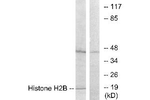 Immunohistochemistry analysis of paraffin-embedded human brain tissue using Histone H2B antibody. (Histone H2B antibody)