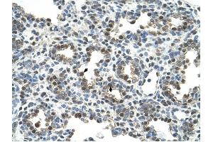 Glycoprotein antibody was used for immunohistochemistry at a concentration of 4-8 ug/ml to stain Alveolar cells (arrows) in Human Lung. (Glycoprotein antibody)