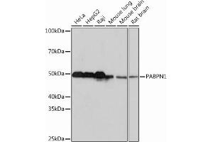 Western blot analysis of extracts of various cell lines, using P Rabbit mAb (ABIN7269445) at 1:1000 dilution. (PABPN1 antibody)