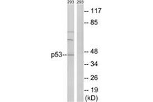 Western blot analysis of extracts from 293 cells, using p53 (Ab-387) Antibody. (p53 antibody  (AA 341-390))