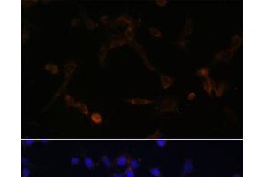 Immunofluorescence analysis of NIH/3T3 cells using UBE2L6 Polyclonal Antibody at dilution of 1:100. (UBE2L6 antibody)