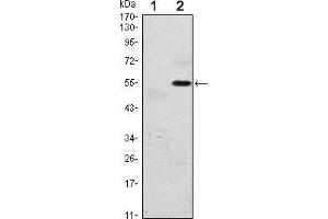 Western blot analysis using EIF2AK3 mAb against HEK293 (1) and EIF2AK3(AA: 929-1116)-hIgGFc transfected HEK293 (2) cell lysate. (PERK antibody)
