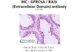 Image no. 2 for anti-G Protein-Coupled Receptor, Family C, Group 5, Member A (GPRC5A) (2nd Extracellular Domain) antibody (ABIN1735207) (GPRC5A antibody  (2nd Extracellular Domain))