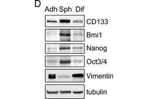 Western Blotting (WB) image for anti-Vimentin (VIM) antibody (ABIN2854814)