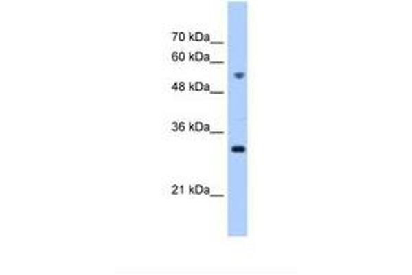 TTC5 antibody  (C-Term)