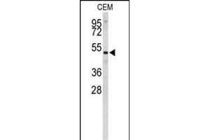 Western blot analysis of CNDP1 Antibody (C-term) (ABIN653113 and ABIN2842697) in CEM cell line lysates (35 μg/lane). (CNDP1 antibody  (C-Term))