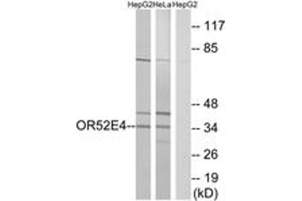 OR52E4 antibody  (AA 200-249)