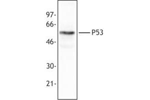 Image no. 1 for anti-Tumor Protein P53 (TP53) (AA 20-25) antibody (ABIN205508) (p53 antibody  (AA 20-25))