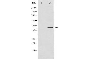 Western blot analysis of p70 S6 Kinase beta expression in 293 whole cell lysates,The lane on the left is treated with the antigen-specific peptide. (RPS6KB2 antibody  (C-Term))