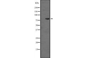 Western blot analysis of TAB3 expression in Hela cell lysate,The lane on the left is treated with the antigen-specific peptide. (TAB3 antibody  (Internal Region))