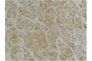 Immunohistochemical analysis of paraffin-embedded Mouse Skeletal Muscle Tissue using Desmin(mAb diluted at 1:200. (Desmin antibody)