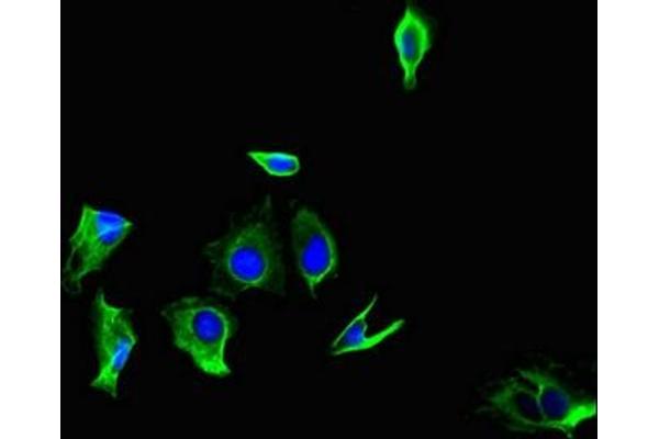 GPR179 antibody  (AA 1440-1671)