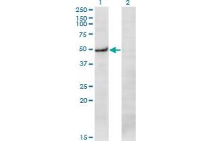 Western Blot analysis of PRKX expression in transfected 293T cell line by PRKX monoclonal antibody (M01), clone 1H7. (PRKX antibody  (AA 269-358))