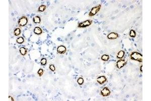 IHC testing of FFPE rat kidney with SLC12A1 antibody. (SLC12A1 antibody)