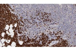 Human thymus: immunohistochemical staining for Terminal Deoxynucleotidyl Transferase. (TdT antibody  (N-Term))