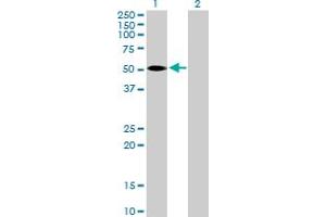Western Blot analysis of BCKDHA expression in transfected 293T cell line by BCKDHA MaxPab polyclonal antibody. (BCKDHA antibody  (AA 1-445))