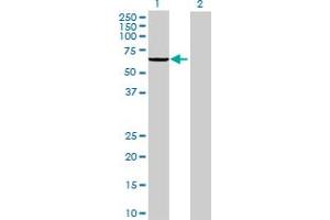 Lane 1: FUT8 transfected lysate ( 63. (FUT8 293T Cell Transient Overexpression Lysate(Denatured))