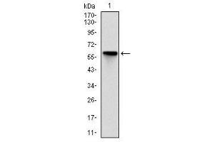 Image no. 1 for anti-rho-Associated, Coiled-Coil Containing Protein Kinase 1 (ROCK1) antibody (ABIN1500698) (ROCK1 antibody)