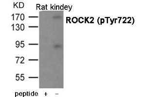 Western blot analysis of extracts from Rat kindey using ROCK2 (Phospho-Tyr722) antibody. (ROCK2 antibody  (pTyr722))