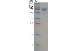 Human IL21R Protein, mFc Tag on SDS-PAGE under reducing condition (IL21 Receptor Protein (AA 20-232) (mFc Tag))