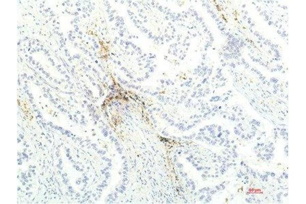 JAK1 antibody  (AA 960-1040)