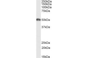 Western Blot using anti-CD2 antibody YTH 655 Human tonsil lysate samples (35 μg protein in RIPA buffer) were resolved on a 10 % SDS PAGE gel and blots probed with the chimeric rabbit version of YTH 655 (ABIN7072214) at 1 μg/mL before detection using an anti-rabbit secondary antibody. (Recombinant CD2 antibody)