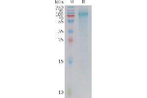 G Protein-Coupled Receptor 133 Protein (GPR133) (AA 26-570) (His tag)