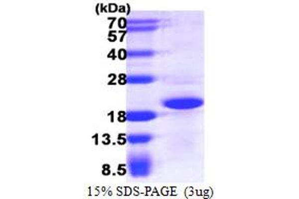 CRCP Protein (AA 1-148) (His tag)