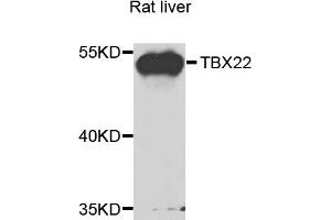 Western blot analysis of extracts of rat liver, using TBX22 antibody. (T-Box 22 antibody)