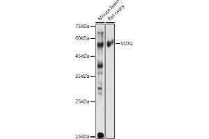 Western blot analysis of extracts of various cell lines, using SOX1 antibody (ABIN3017344, ABIN3017345, ABIN3017346 and ABIN1682856) at 1:1000 dilution. (SOX1 antibody)