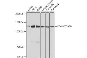Western blot analysis of extracts of various cell lines, using CD41/ITGB Rabbit mAb (ABIN7267925) at 1:1000 dilution. (Integrin Alpha2b antibody)