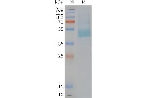 Human CM-Nanodisc, Flag Tag on SDS-PAGE (CMKLR1 Protein)
